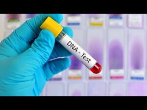 DNA testing in Uganda / Public Opinion